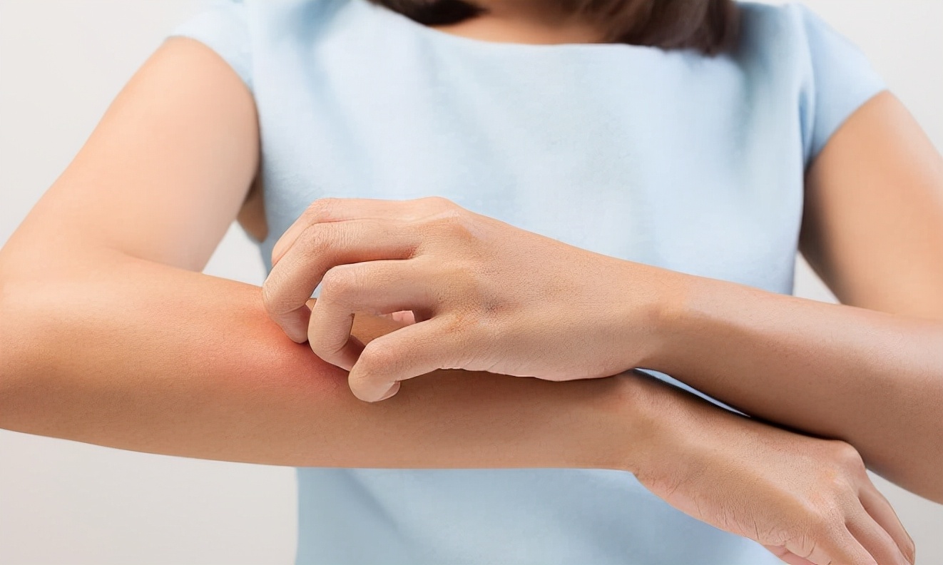 过敏性荨麻疹越来越严重怎么办,过敏性荨麻疹反复发作怎么办