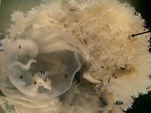 产前检查的次数与方案,产前检查需要检查几次