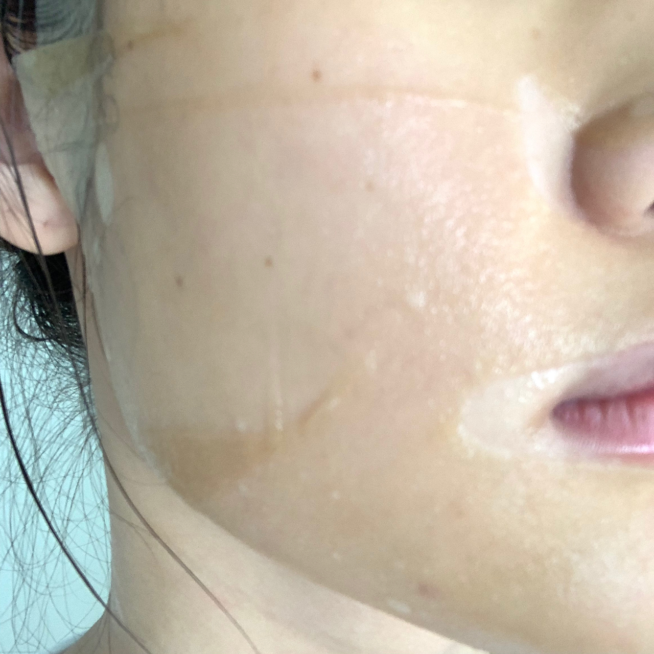 拯救痘痘肌肤的救星来啦,痘痘肌改善痘印产品推荐