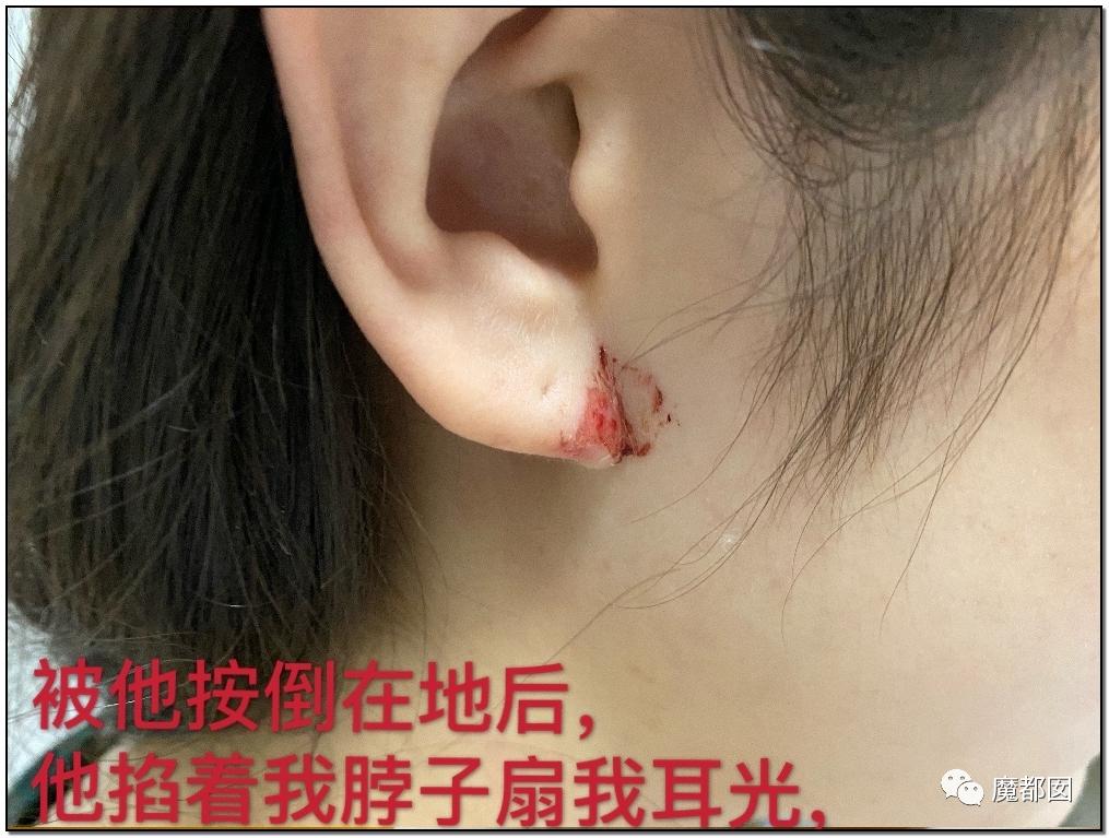 短跑名将张培萌家暴事件,短跑名将张培萌被控家暴