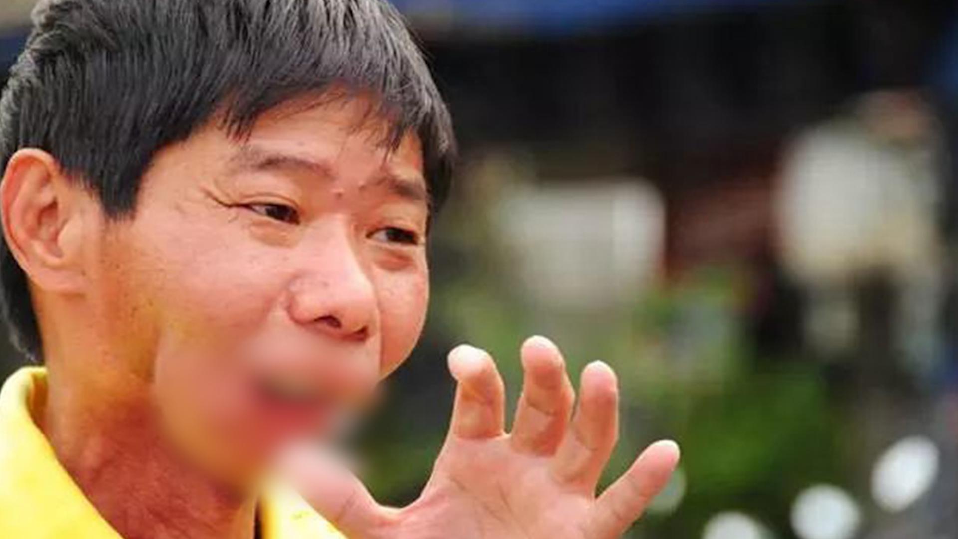 一级致癌物槟榔的危害有多大,槟榔为何致癌刷新你对槟榔的认知