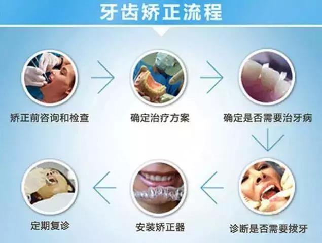 做牙套的工资一般多少,戴个牙套有什么用