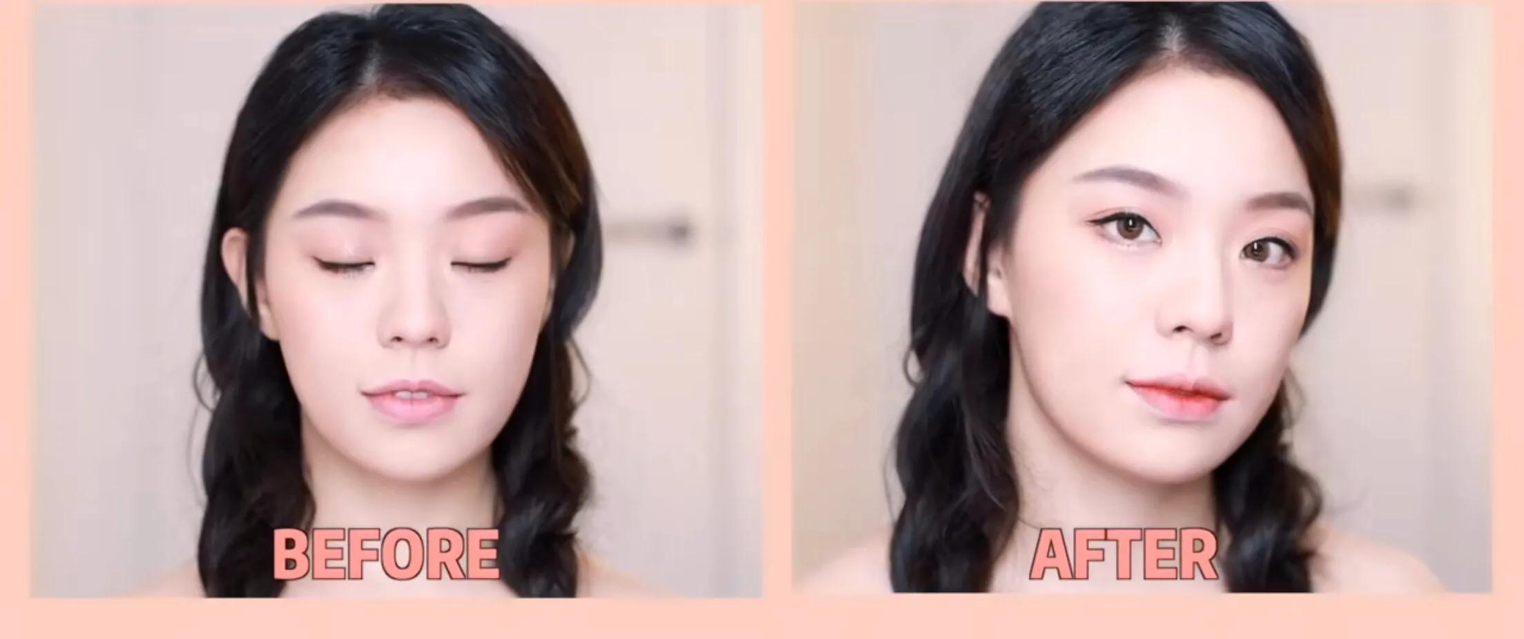 侧颜凸嘴怎么修,让侧脸变好看的方法