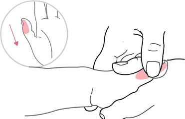 地图舌花剥苔的孩子怎么调理