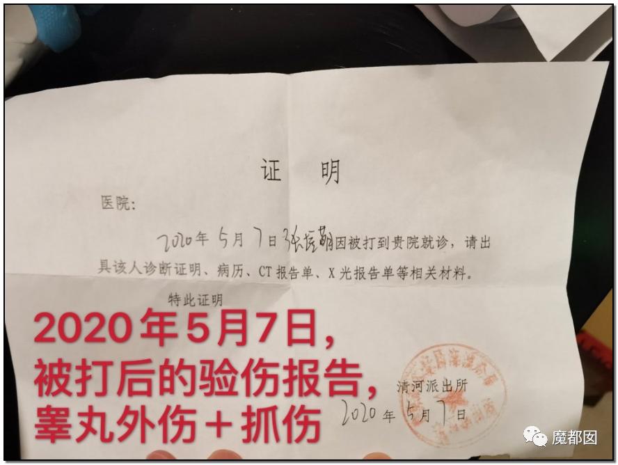 短跑名将张培萌被曝家暴,短跑名将张培萌殴打岳母被行拘