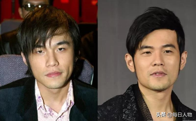 脱发知识普及,当代脱发现状