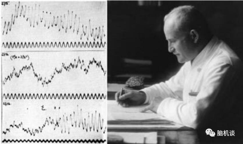 ​《脑机往事（3）—维达尔的秘密》