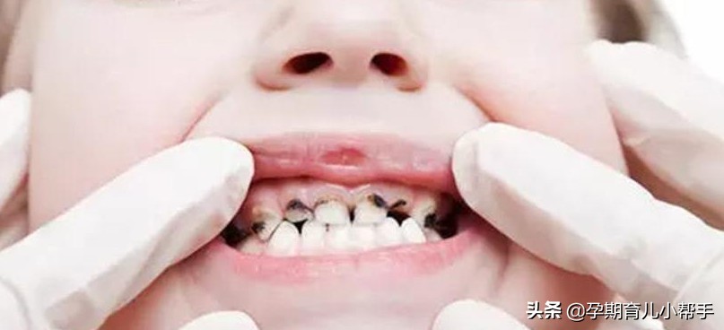 宝宝多大戒奶瓶戒晚了危害这么多,小孩怎么戒奶瓶最好的方法