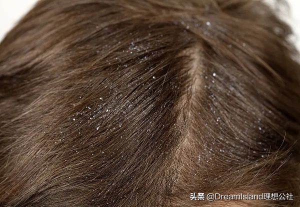 夏日指南送你一份好物清单,夏日必备好物备上它想不美都难