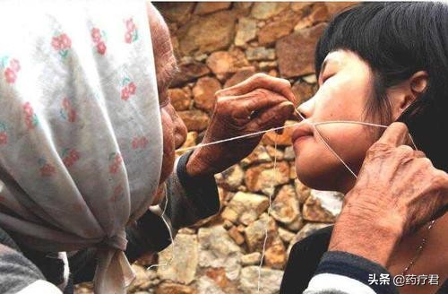 女性嘴唇长胡子怎么彻底去除,女生嘴唇为何长胡子