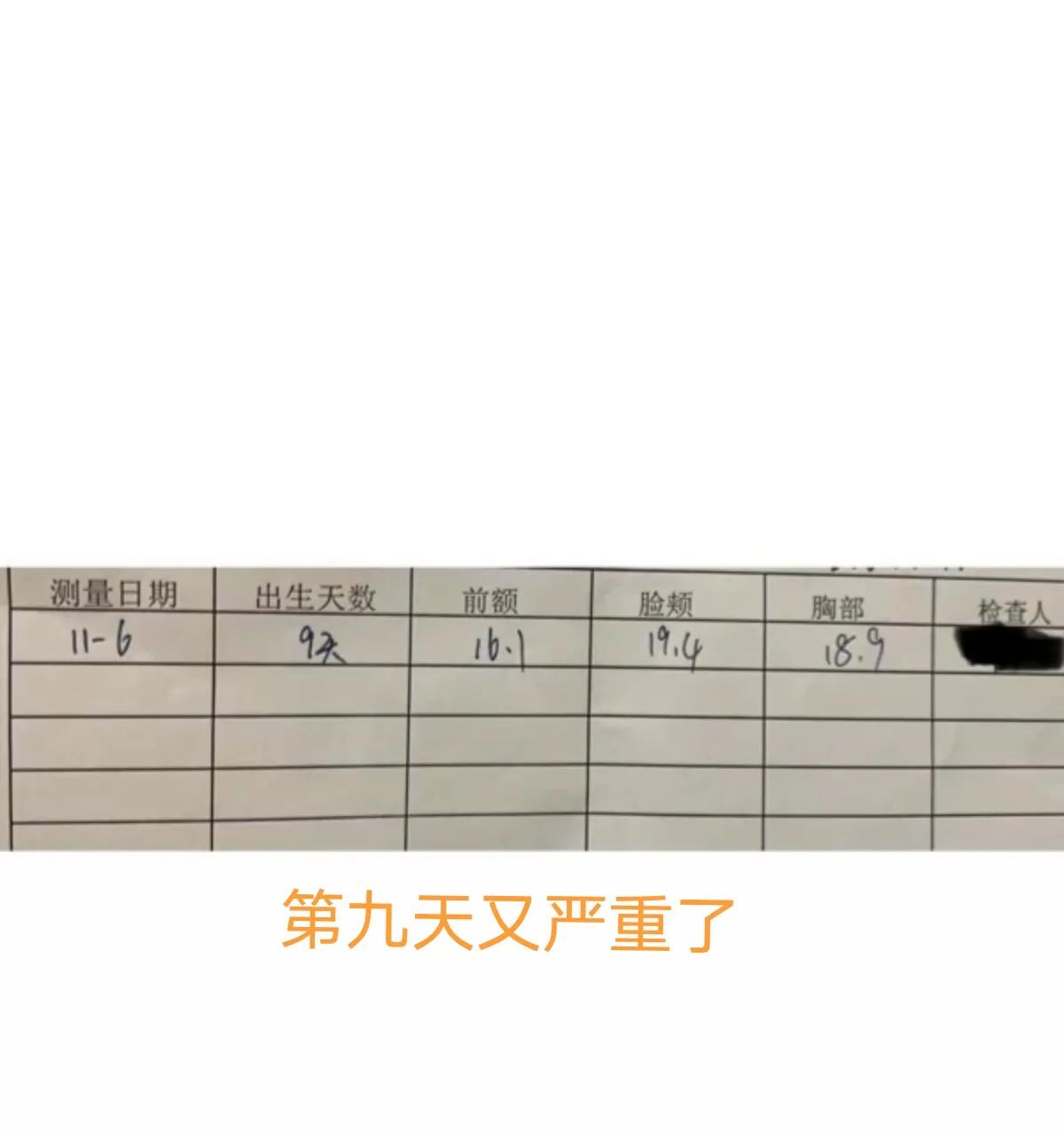 宝宝黄疸好转有哪些征兆,亲身经历宝宝黄疸过程