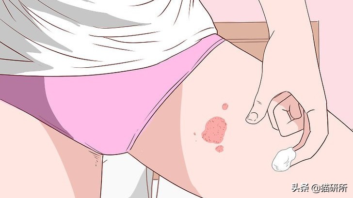 你们的猫咪猫癣怎么治好的,亲身经历的猫癣怎么治