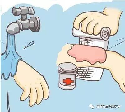 烧烫伤后有疤痕怎么办？《祝您健康》昭通市第二人民医院保刘俊医生支招