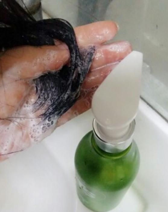 大多数脱发患者用哪些方法治疗脱发？效果都怎么样？