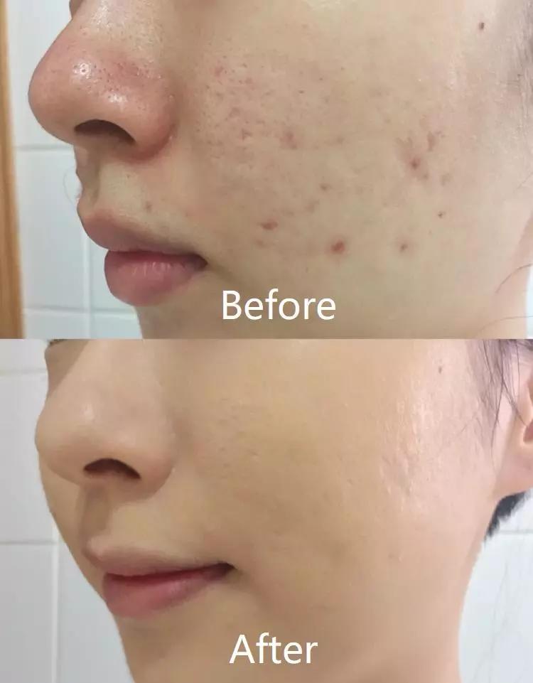 毛戈平气垫好物分享,口碑比较好的气垫毛戈平