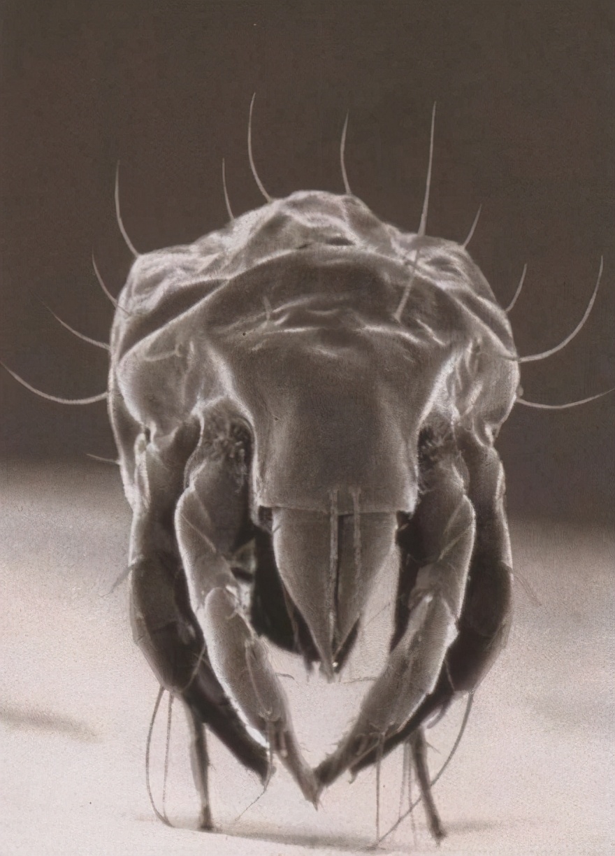 脖子腋下腹股沟长小肉粒怎么去除,腋下脖子上长小肉粒是什么原因