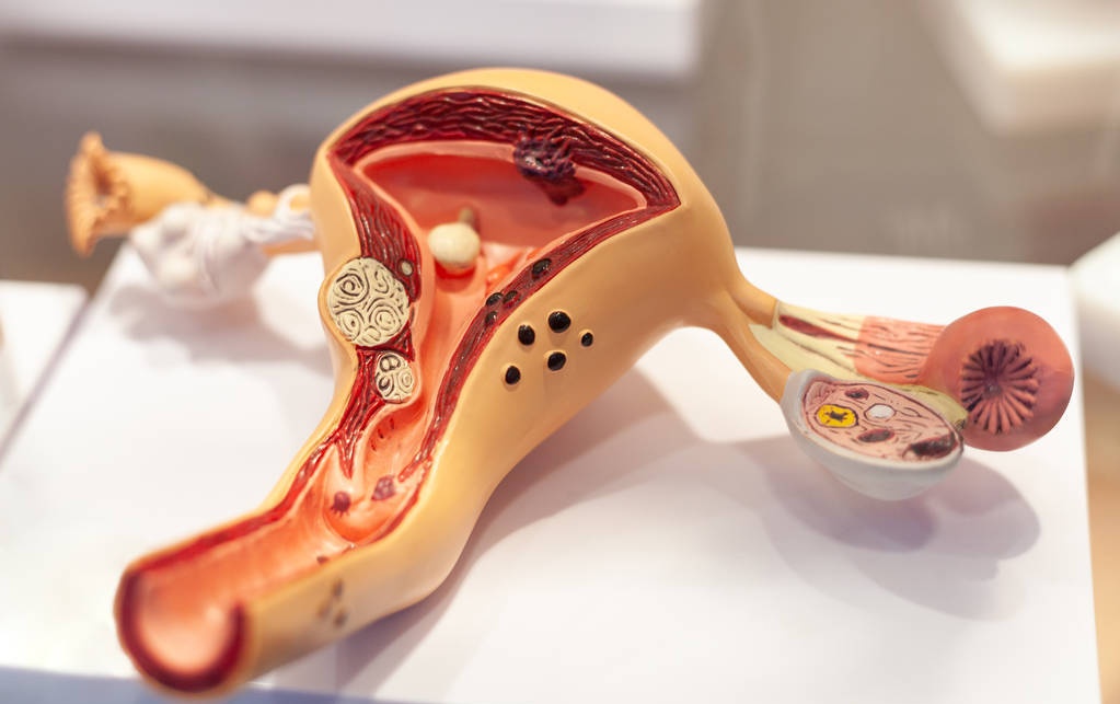 女儿腺肌症痛经卧床，妈妈不给雇护工，原来世上最难的职业是妈妈