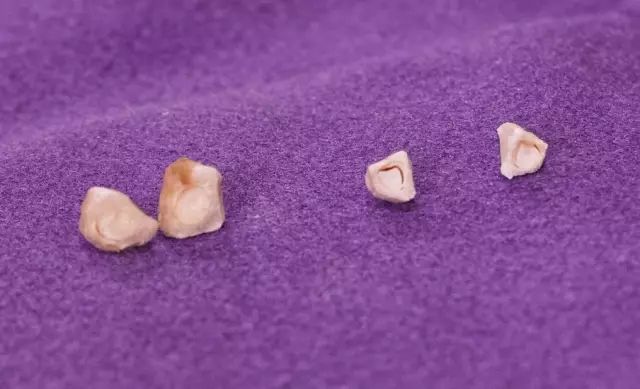 2岁多小孩吃石榴不吐籽,孩子吃石榴不吐籽有危害吗