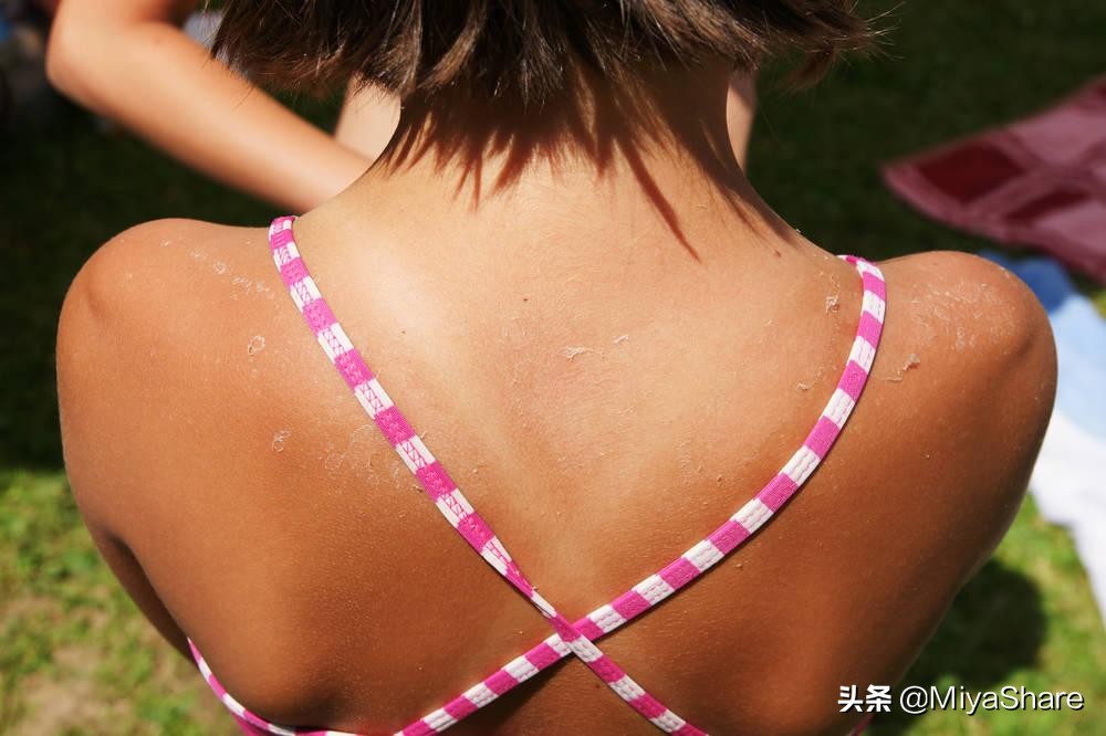 晒后斑点修复最有效的办法,暴晒后怎么补救防止变黑