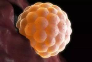 试管胎停育后二次移植成功率高吗,试管移植时憋尿太多影响成功率吗