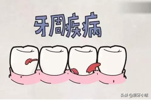 中年人牙齿松动拔了好还是脱落好,牙齿松动就拔好还是很松拔牙好