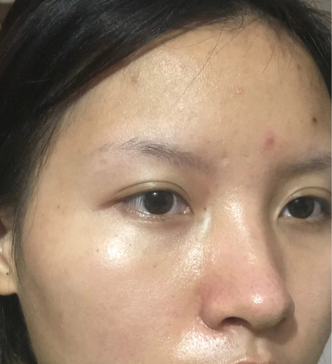 油性皮肤更抗衰老吗,油性皮肤保湿有用吗