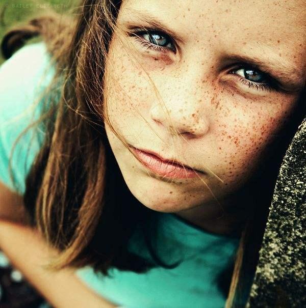 脸上的斑反映身体哪里出了问题,脸上绿豆大小的斑点是什么斑