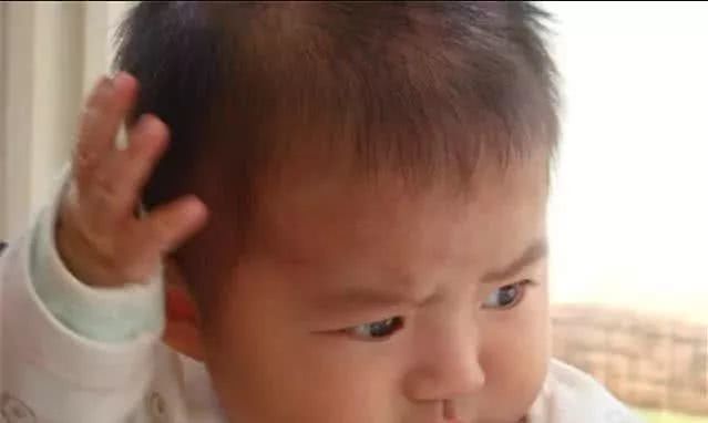 小孩经常有小动作挠脸挠头揉眼睛,宝宝总是挠头什么意思