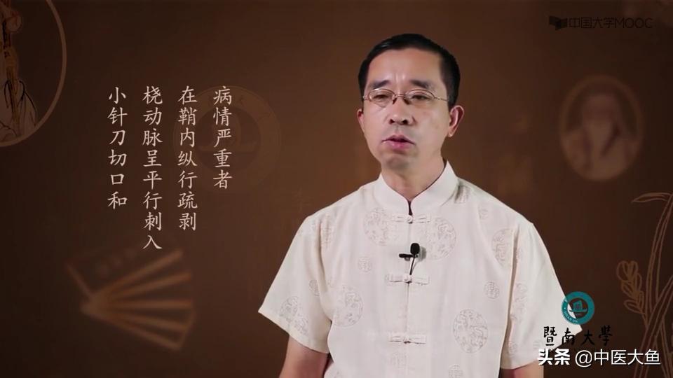 桡骨茎突狭窄性腱鞘炎怎么治疗,桡骨茎突狭窄性腱鞘炎治疗方法