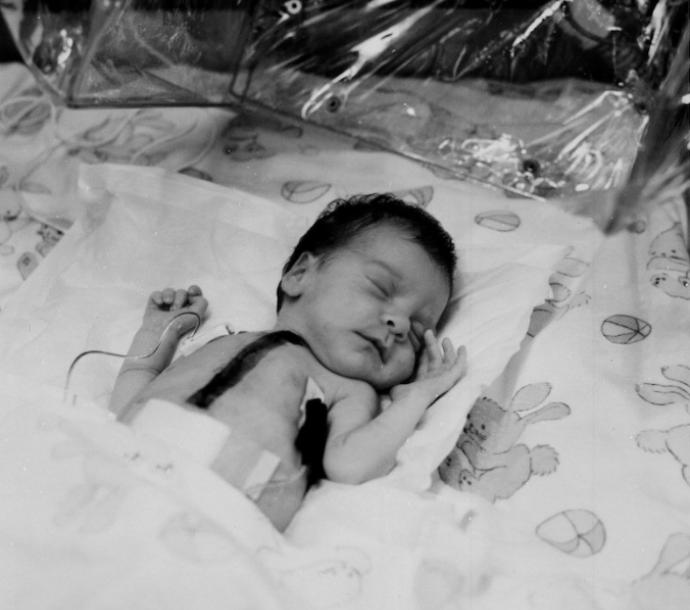 80年代移植狒狒心脏的婴儿,第一个移植狒狒心脏的美国女孩