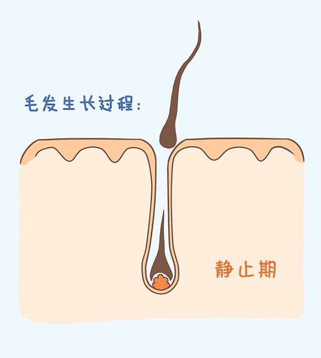 激光脱毛能永久吗脸上,激光脱毛能永久吗知乎