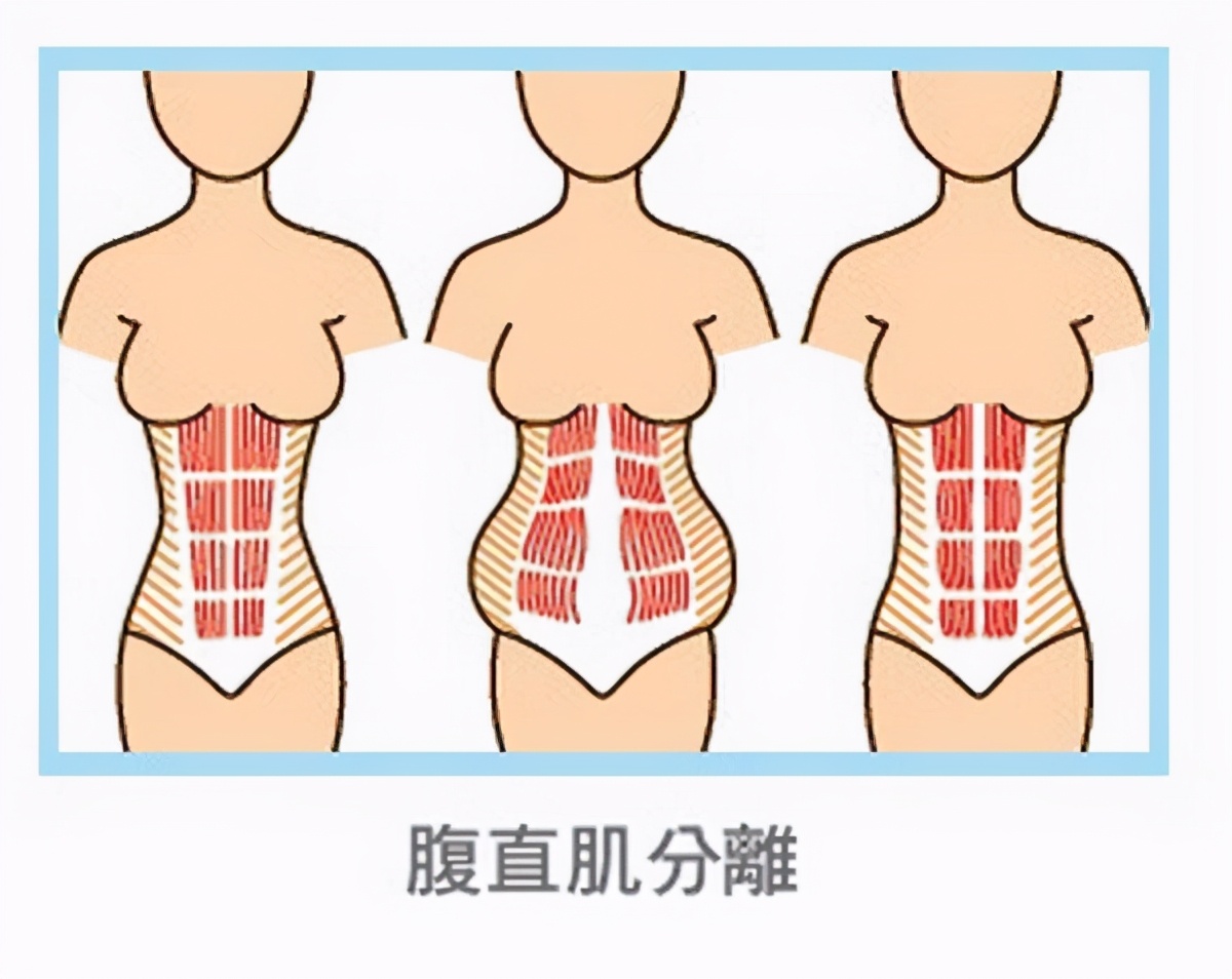 产后腹带正确绑法图,产后绑腹带能瘦肚子吗
