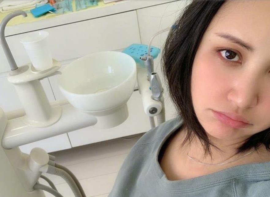 张歆艺孕期护肤,张歆艺牙