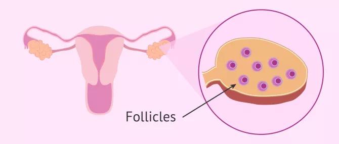 取卵后出现腹水？别慌，你该这么做...