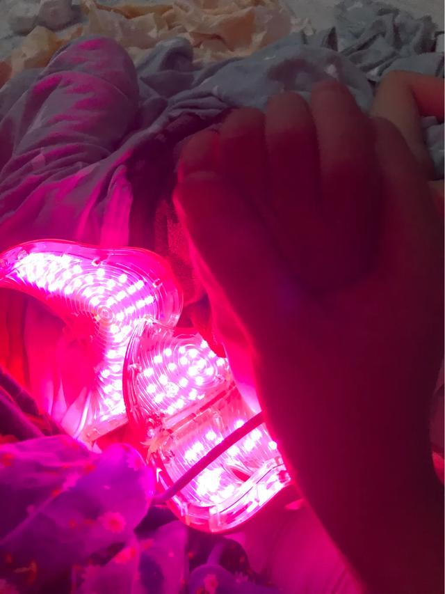 孩子大面积烫伤治疗流程,记录女儿被烫伤到治疗全过程