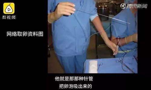 姑娘,“卖卵”会彻底毁掉你的人生