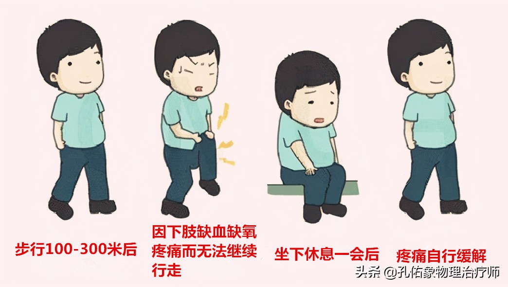 老年人腿脚无力要怎么避免,专治老年人下肢无力的方法