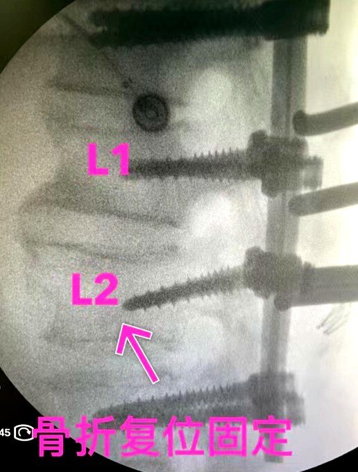分秒必争救伤员,分秒必争的抢救