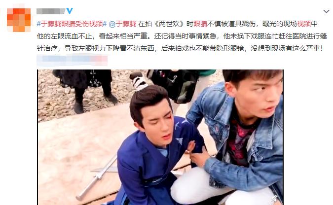 于朦胧剧组受伤视频曝光，左眼被戳流血不止，曾拍戏摔伤五处骨折