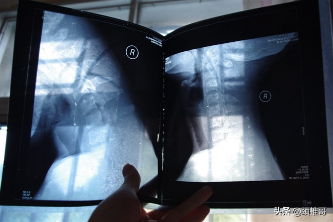 21岁经常头晕是怎么回事,20多岁头晕昏昏沉沉的怎么回事