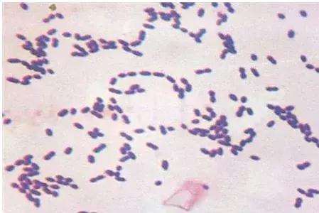 你正用的枕头是腰痛、脑梗的元凶？家有这种枕头的，抓紧时间换掉