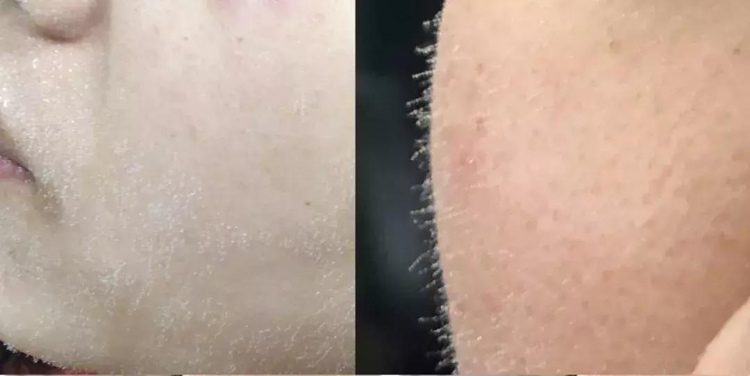 有了前法国第一夫人的百元“黑科技”眼霜,我把3000块眼霜扔了!