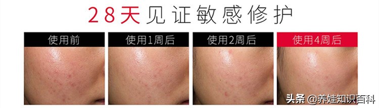 天天熬夜带娃瘦了,天天熬夜带娃也不见瘦