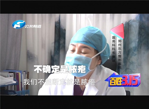 割双眼皮线没有拆干净出脓包了,郑州东方整形医院双眼皮成功案例