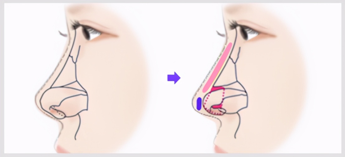 医美业绩一个月如何突破100w,医美机构业绩翻倍