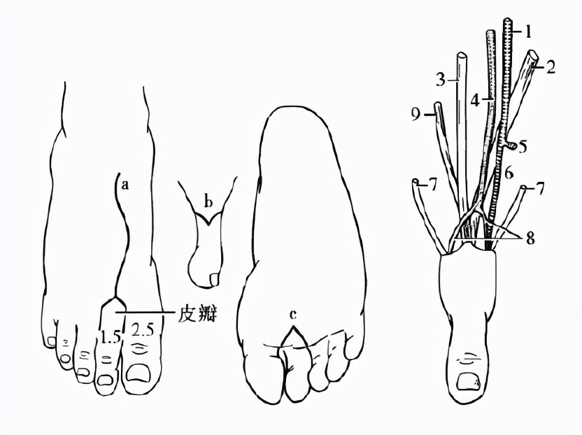 大拇指断了为什么只能用脚趾接,大拇指断了用脚拇指代替