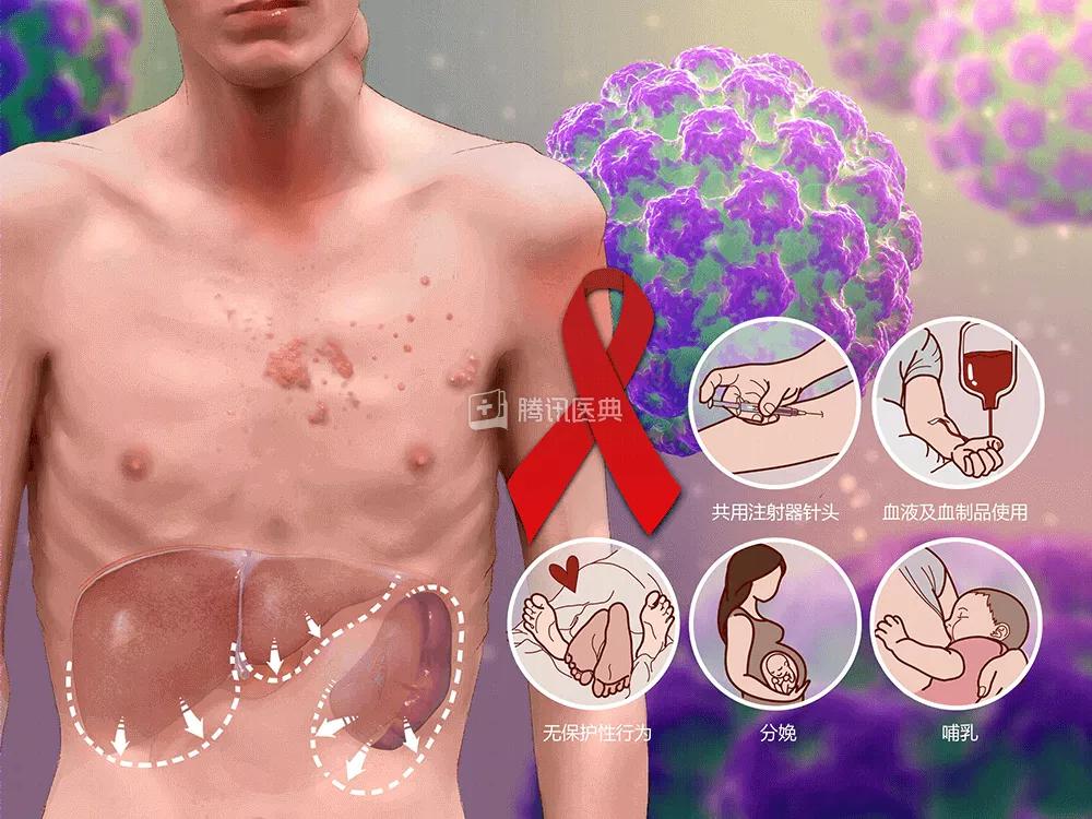 广州街头被人扎针是真的假的,两网友称在广州被人扎针后续