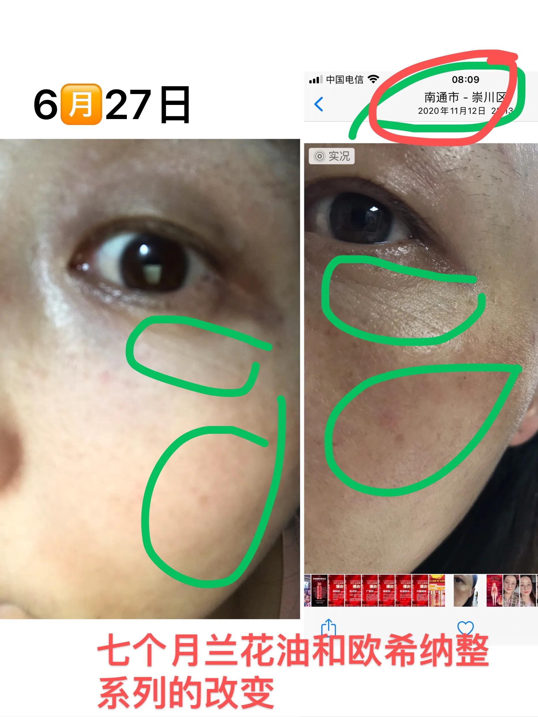 精华油天花板,精华液天花板