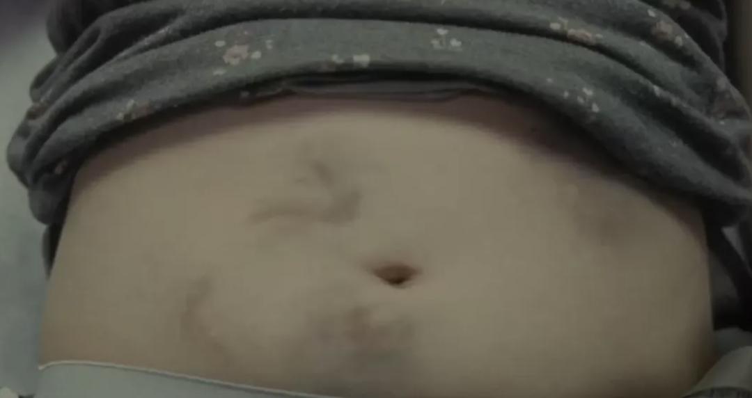 波兰反对堕胎的历史,波兰反对最严堕胎法