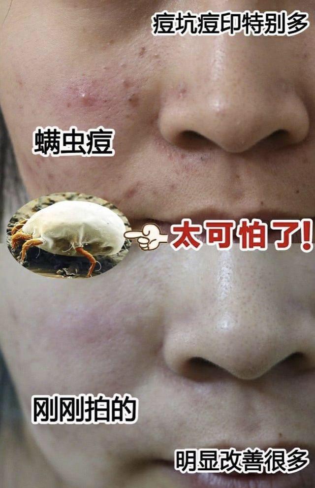 张天爱视频用的保养护肤面霜,张天爱作息曝光视频